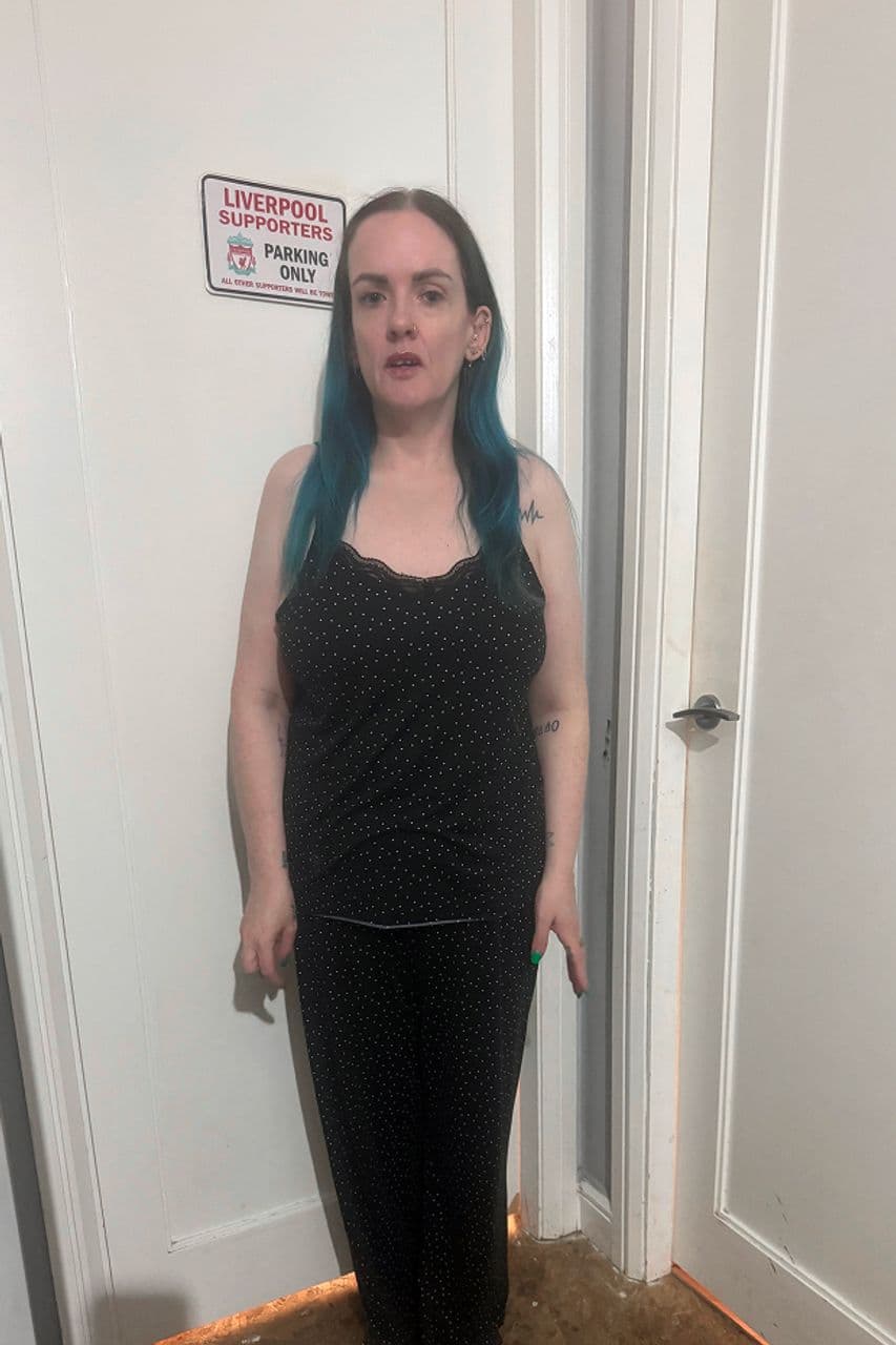 Liza after starting treatment with myBMI