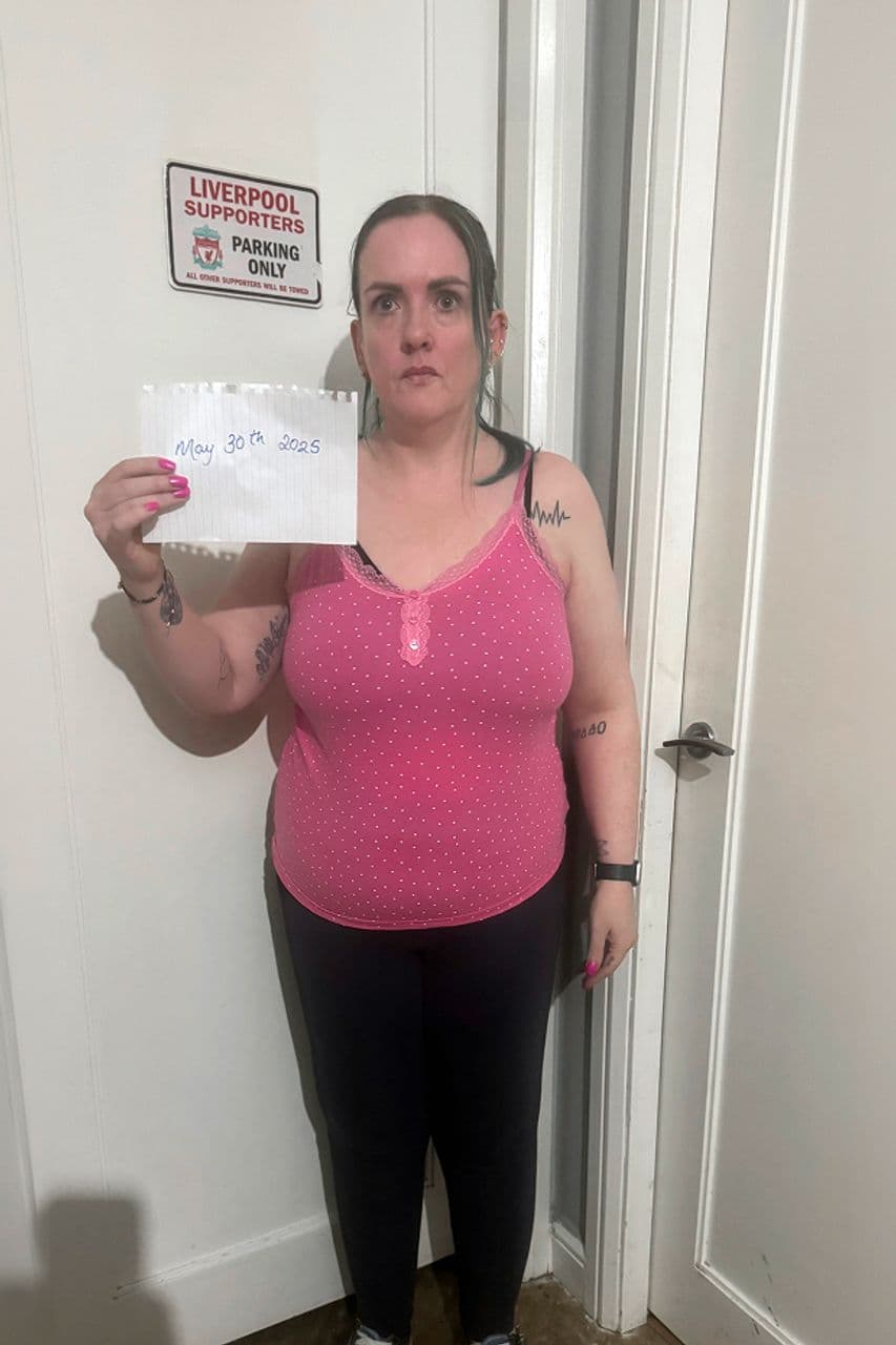 Liza before starting treatment with myBMI