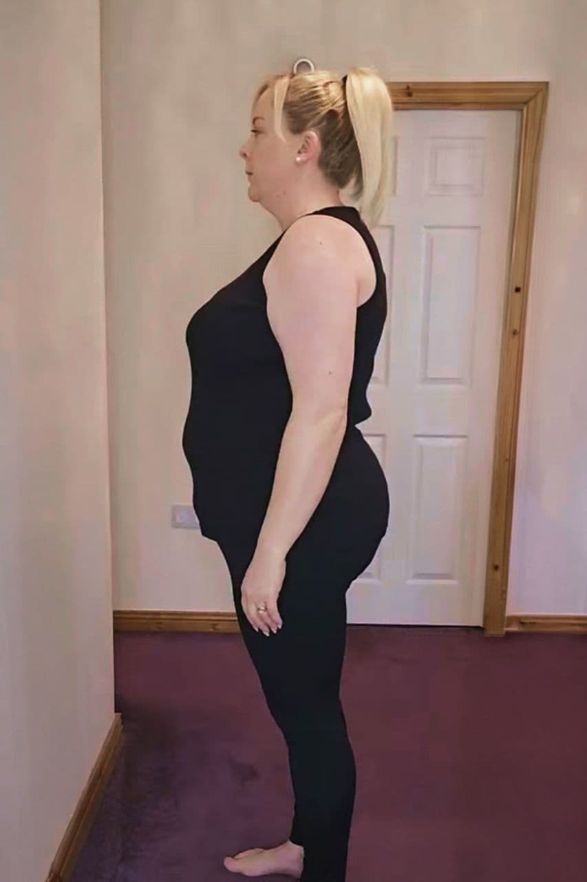 Lorna before starting her weight loss journey with myBMI